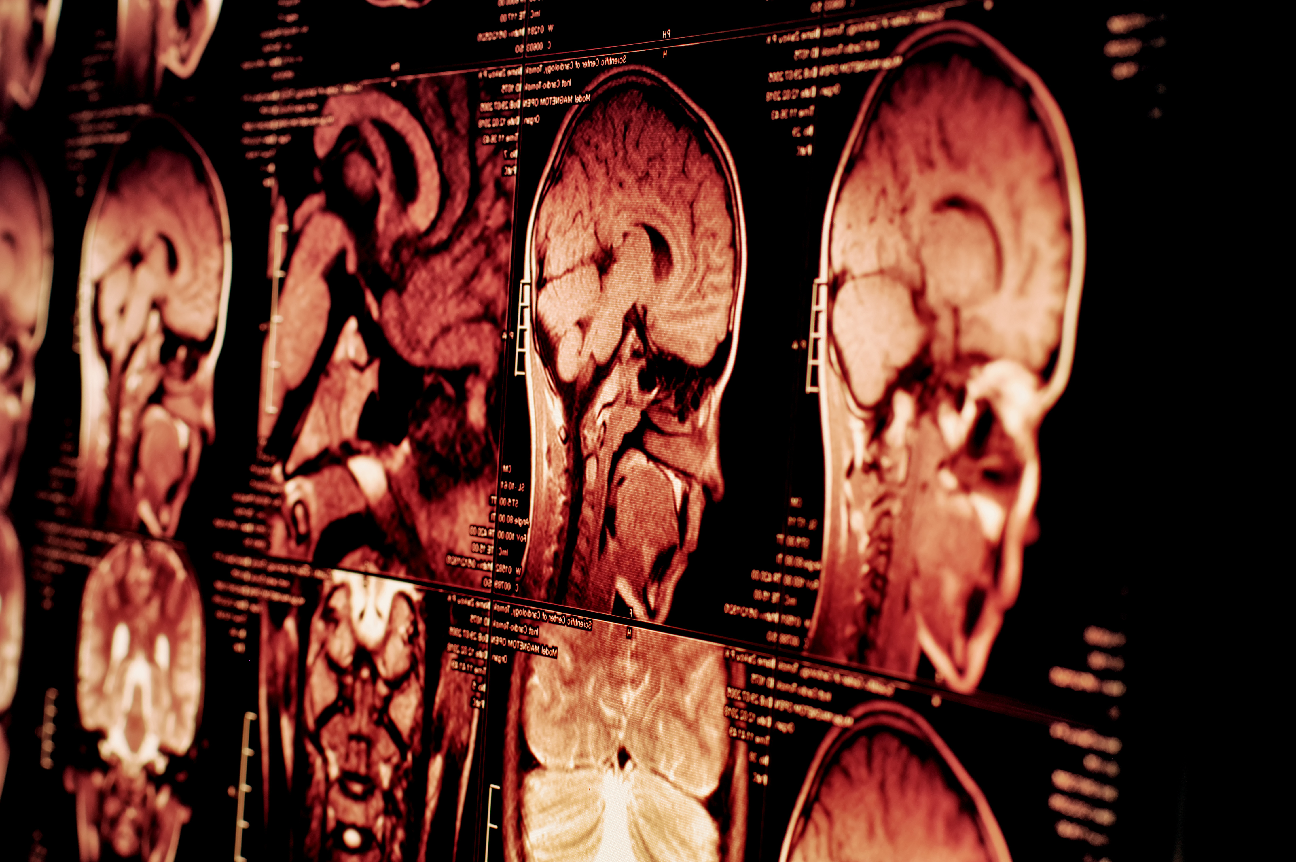 brain scan images
